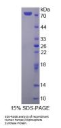 Human Farnesyl Diphosphate Synthase (FDPS) Protein
