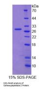 Human Carboxypeptidase Z (CPZ) Protein