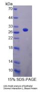 Human Epithelial Stromal Interaction 1, Breast (EPSTI1) Protein