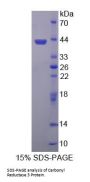 Human Carbonyl Reductase 3 (CBR3) Protein