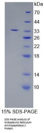 Human Endoplasmic Reticulum Aminopeptidase 2 (ERAP2) Protein