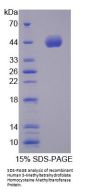 Human 5-Methyltetrahydrofolate Homocysteine Methyltransferase (MTR) Protein