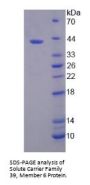 Human Solute Carrier Family 39, Member 6 (SLC39A6) Protein