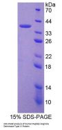 Human Peptidyl Arginine Deiminase Type VI (PADI6) Protein