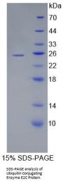 Human Ubiquitin Conjugating Enzyme E2C (UBE2C) Protein