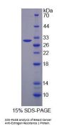 Human Breast Cancer Anti-Estrogen Resistance 1 (BCAR1) Protein