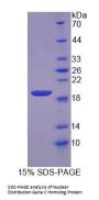 Human Nuclear Distribution Gene C Homolog (NUDC) Protein
