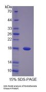 Human Pantothenate Kinase 4 (PANK4) Protein