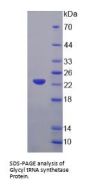 Human Glycyl-tRNA Synthetase (GARS1) Protein
