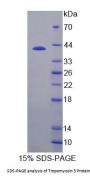 Human Tropomyosin 3 (TPM3) Protein