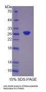 Human Ribonucleotide Reductase M1 (RRM1) Protein