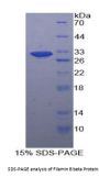 Human Filamin B Beta (FLNb) Protein