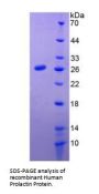 Human Prolactin (PRL) Protein