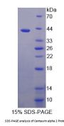 Human Centaurin Alpha 2 (CENTa2) Protein