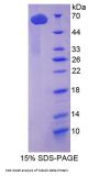 Human Tubulin Delta (TUBd) Protein