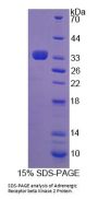 Human Adrenergic Receptor Beta Kinase 2 (ADRbK2) Protein
