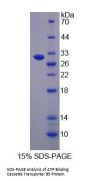 Human ATP-Binding Cassette Subfamily B Member 5 (ABCB5) Protein