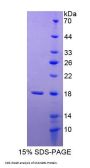 Human Mannosidase Alpha Class 2B Member 1 (MAN2B1) Protein