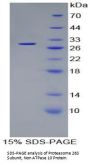 Human 26S Proteasome Non-ATPase Regulatory Subunit 10 (PSMD10) Protein