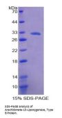 Human Polyunsaturated Fatty Acid Lipoxygenase ALOX15B (ALOX15B) Protein
