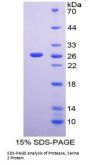 Human Serine Protease 2 (PRSS2) Protein