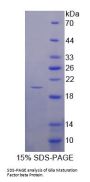 Human Glia Maturation Factor Beta (GMFb) Protein