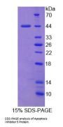 Human Apoptosis Inhibitor 5 (API5) Protein