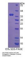 Human Proto-Oncogene Tyrosine-Protein Kinase ROS (ROS1) Protein
