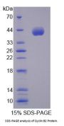 Human Cyclin B2 (CCNB2) Protein