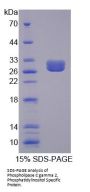 Human Phospholipase C Gamma 2, Phosphatidylinositol Specific (PLCg2) Protein