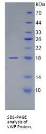 Human Von Willebrand Factor (vWF) Protein