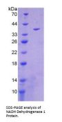 Human NADH Dehydrogenase 1 (ND1) Protein
