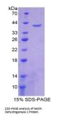 Human NADH Dehydrogenase 1 (ND1) Protein
