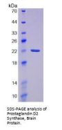 Human Prostaglandin D2 Synthase, Brain (PGD2S) Protein