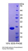 Human Angiopoietin-1 Receptor / TIE2 (TEK) Protein