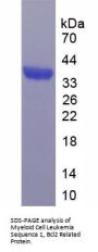 Human Induced Myeloid Leukemia Cell Differentiation Protein (MCL1) Protein