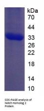 Human Notch Homolog 2 (NOTCH2) Protein