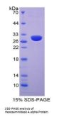 Human Hexosaminidase A Alpha (HEXa) Protein