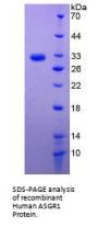 Human Asialoglycoprotein Receptor 1 (ASGR1) Protein