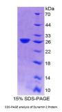 Human Dynamin 2 (DNM2) Protein