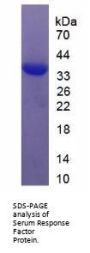 Human Serum Response Factor (SRF) Protein