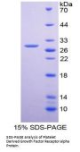 Human Platelet Derived Growth Factor Receptor Alpha (PDGFRa) Protein