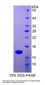 Human Carcinoembryonic Antigen Related Cell Adhesion Molecule 6 (CEACAM6) Protein