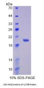 Human Interleukin 17 Receptor B (IL17RB) Protein