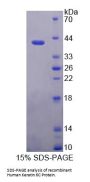 Human Keratin 6C (KRT6C) Protein