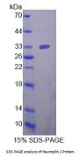 Human Neuropilin 2 (NRP2) Protein