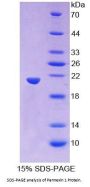 Human Pannexin 1 (PANX1) Protein