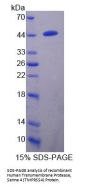 Human Transmembrane Protease, Serine 4 (TMPRSS4) Protein