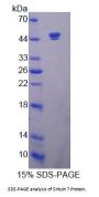 Human Sirtuin 7 (SIRT7) Protein