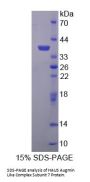 Human HAUS Augmin Like Complex Subunit 7 (HAUS7) Protein